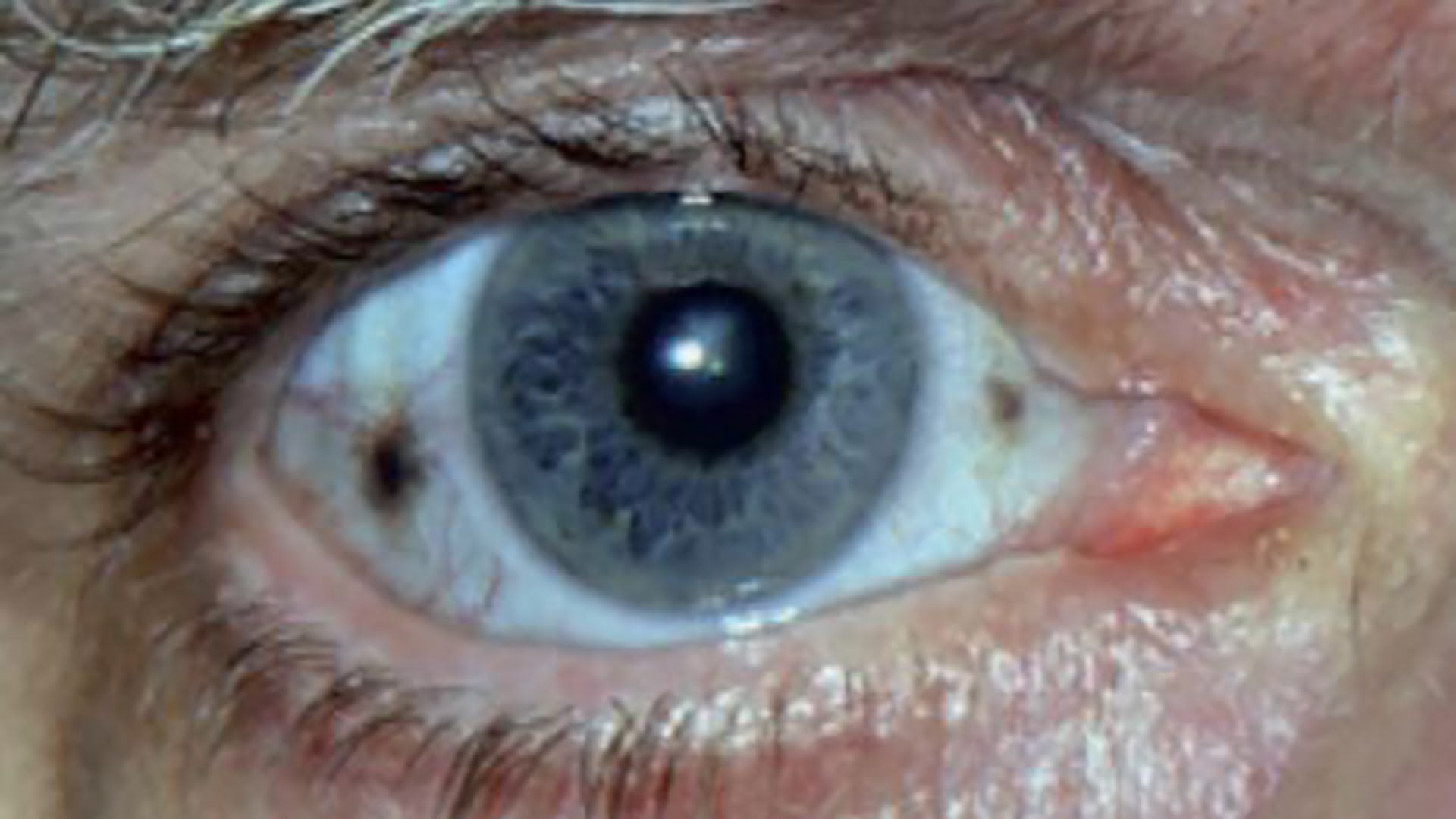 Black Bone Disease 05/12/20 | Sky.com