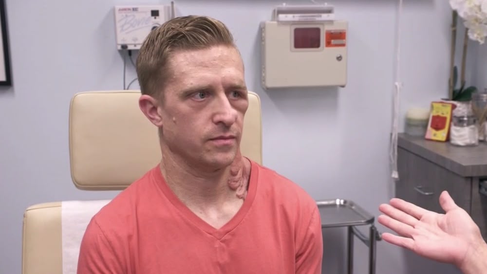 Dr pimple popper full episodes shop